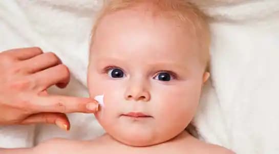 Bebeklerde Sedef Hastalığı Belirtileri ve Doğru Bakım Yöntemleri Hakkında Kapsamlı Bilgi