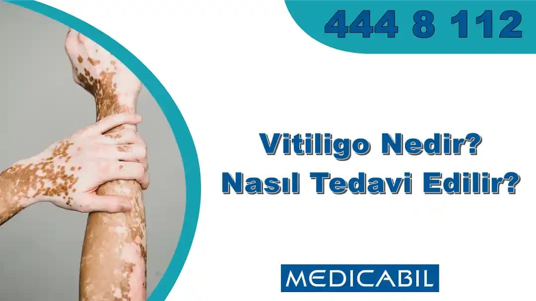 Ciltte Pigment Eksikliği: Kozmetik Yaklaşımlar ve Güncel Çözümler Hakkında Detaylı Bilgi