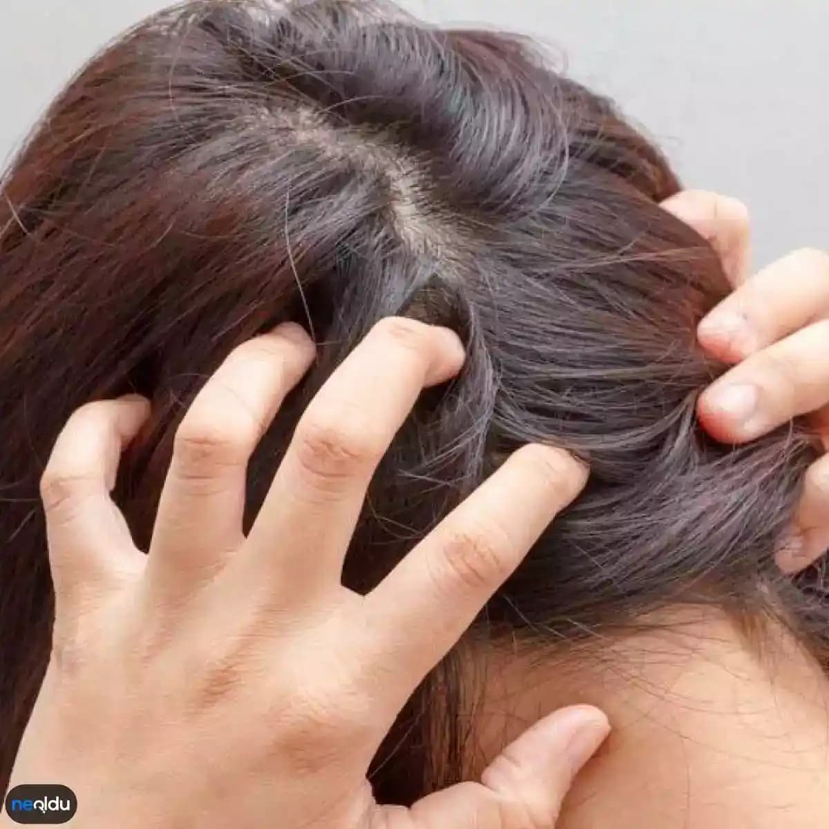 Saç Diplerindeki Kaşıntının Nedenleri ve Çözüm Yolları Hakkında Detaylı Bilgi