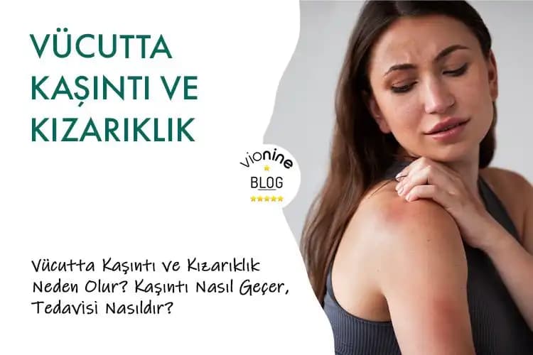 Vücutta Nokta Nokta Kızarıklık ve Kaşıntı Nedenleri, Belirtileri ve Çözüm Yolları